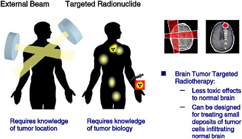 overview of commercial treatment planning systems for targeted radionuclide therapy