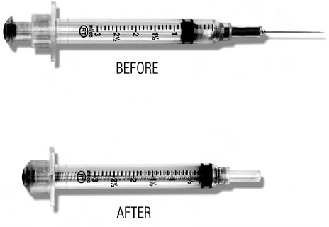FIGURE App-D-12 The RTI VanishPoint® syringe.