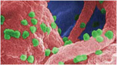 HIV particles (green spheres).