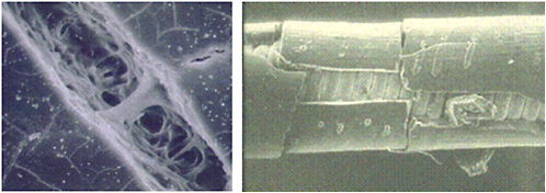 FIGURE 3.14 Large magnification of environmental stress cracking from biological stress cracking of sample under mechanical stress (left) and metal ion oxidation on inner insulation of pacing lead (right). Note impression from outer coils on polymer. SOURCE: Courtesy of Medtronic.