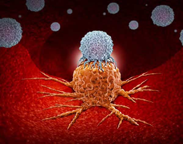 Artist’s depiction of a T cell
attacking a cancer cell.