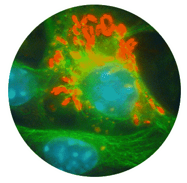 image of legionella bacteria